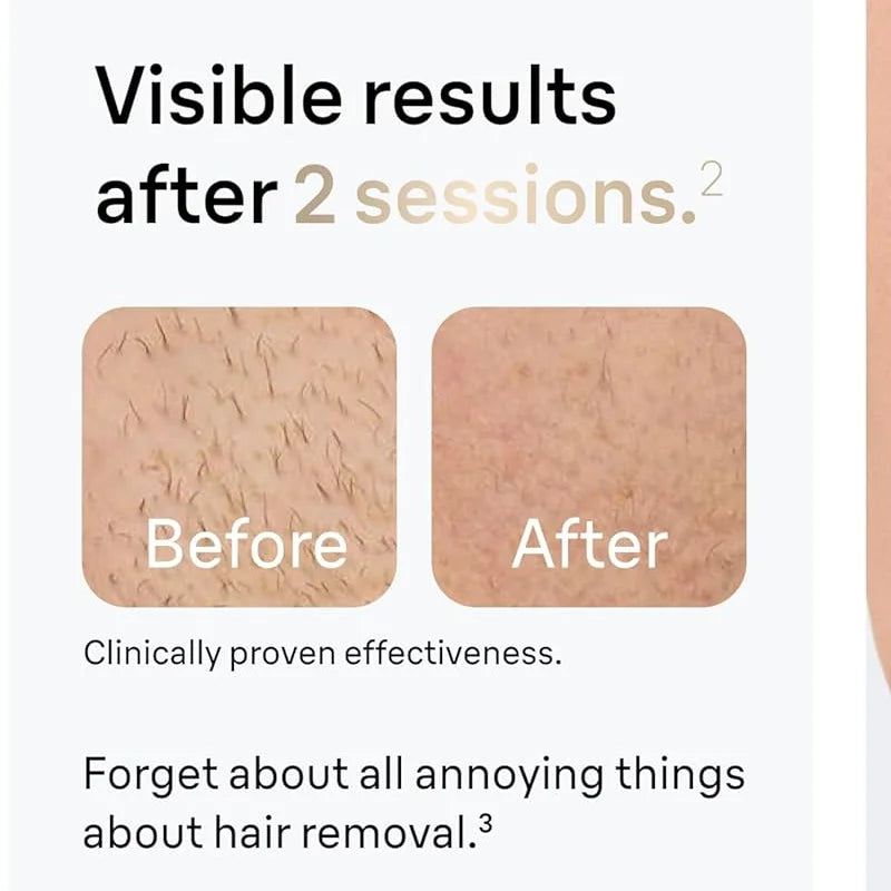 Depilador IPL Profesional – Eliminación de Vello en Casa